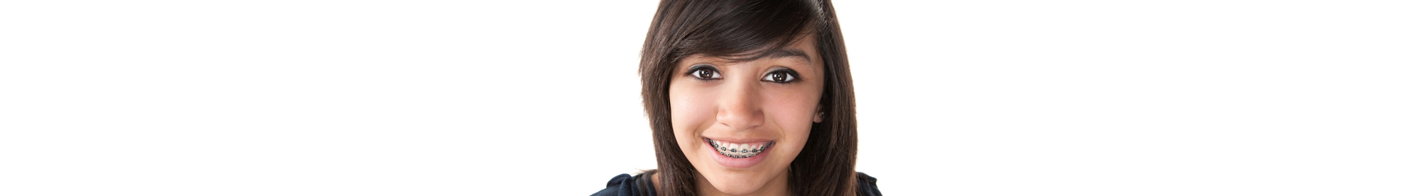 types of braces